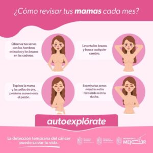 Reconoce los síntomas del cáncer de mama para actuar de inmediato-Morelia Informativo1