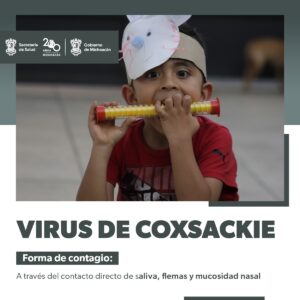 Virus coxsackie forma de contagio-Morelia Informativo 