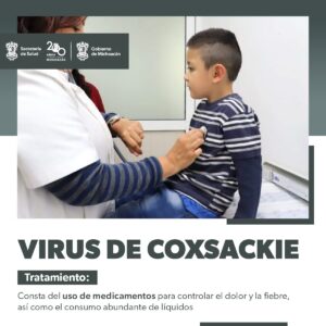 Virus coxsackie tratamiento-Morelia Informativo 