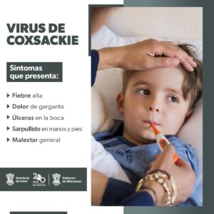 Virus coxsackie síntomas-Morelia Informativo 