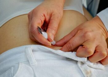 SSM implantes hormonales gratuitos