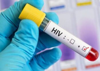 Realiza SSM pruebas rápidas y gratuitas de hepatitis C, VIH y sífilis