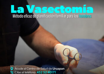 Vasectomía