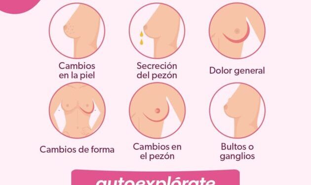 Reconoce los síntomas del cáncer de mama para actuar de inmediato-Morelia Informativo