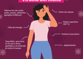 Brindan orientación telefónica gratuita sobre viruela símica