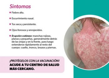 Identifica los síntomas del sarampión y protege tu salud: SSM