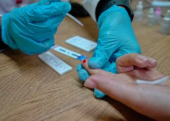 SSM realiza sin costo prueba rápida para detectar la hepatitis C