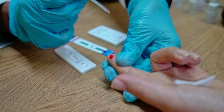 SSM realiza sin costo prueba rápida para detectar la hepatitis C