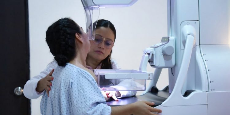 Con 28 mil estudios de mama, la SSM intensifica lucha contra el cáncer