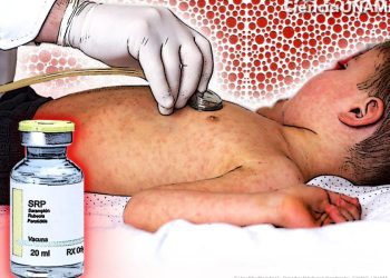 Disponibles más de 200 mil dosis de vacunas contra el sarampión: SSM