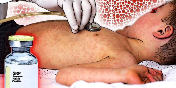 Disponibles más de 200 mil dosis de vacunas contra el sarampión: SSM